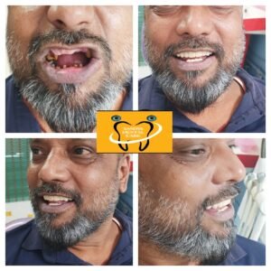 Cosmetic restoration